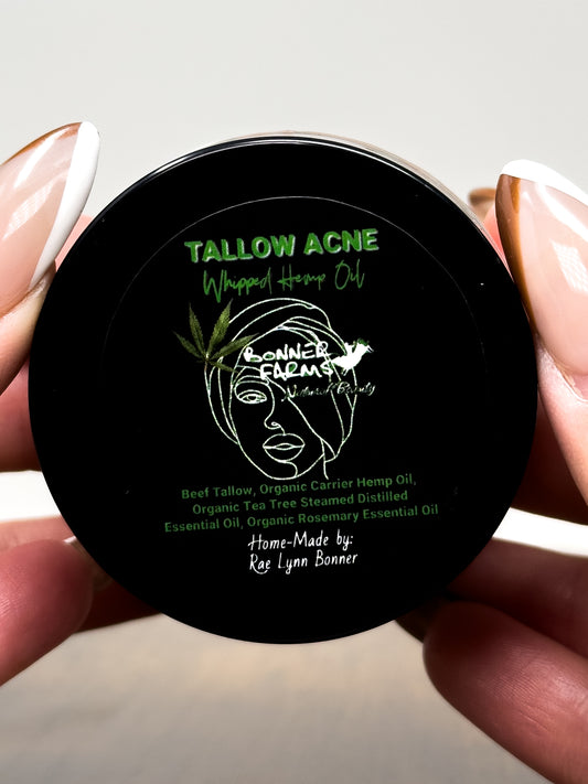 Whipped Grass-Fed Tallow Acne Cream with Hemp Oil